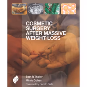 Cosmetic Surgery After Massive Weight Loss