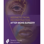 Aesthetic Facial Reconstruction After Mohs Surgery
