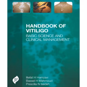 Handbook Of Vitiligo Basic Science And Clinical Management