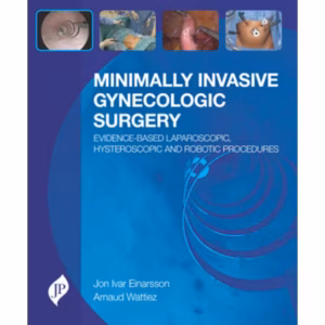 Minimally Invasive Gynecologic Surgery Evidence-Based Lap.Hyster. And Robotic Procedures