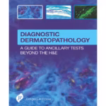 Diagnostic Dermatopathology:A Guide To Ancillary Tests Beyond The H&E