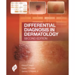 Differential Diagnosis In Dermatology