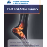 Surgical Techniques In Sports Medicine Foot And Ankle Surgery