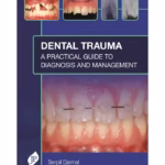 Dental Trauma: A Practical Guide To Diagnosis And Management