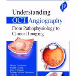 Understanding Oct Angiography From Pathophysiology To Clinical Imaging