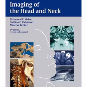 Imaging of the Head and Neck