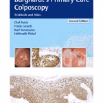 Burghardt's Primary Care Colposcopy 2nd Edition