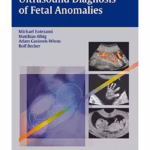 Ultrasound Diagnosis of Fetal Anomalies