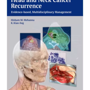 Head and Neck Cancer Recurrence Evidence-based Mul
