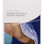 Concepts and Cases in Nonunion Treatment