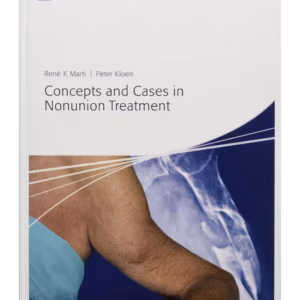 Concepts and Cases in Nonunion Treatment