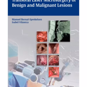 Transoral Laser Microsurgery of Benign and Malignant Lesions 1st Edition
