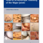 Atlas of Arthroscopic Anatomy of Major Joints 1st Edition