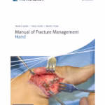 AO Manual of Fracture Management - Hand 1st Edition