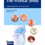 The Frontal Sinus : Surgical Approaches and Controversies 1st Ed.