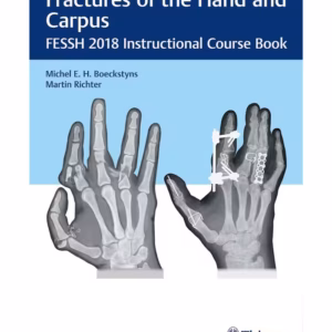 Fractures of the Hand and Carpus Fessh 2018 Instructional Course Book