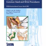 Management of Complications in Common Hand and Wrist Procedures 1st Ed.: FESSH Instructional Course Book 2021