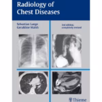 Radiology of Chest Diseases 3rd Edition