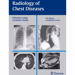 Radiology of Chest Diseases 3rd Edition
