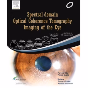 Spectral Domain Optical Coherence Tomography Imaging of the Eye