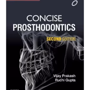 Concise Prosthodontics - 2nd Edition