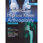 Basics in Hip and Knee Arthroplasty - 2nd Edition