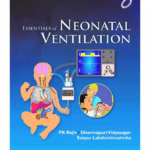 Essentials of Neonatal Ventilation -1st Edition