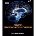 Clinical Electroencephalography -2nd Edition