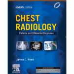 Chest Radiology: Patterns and Differential Diagnoses (SAE) -7th Edition