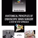 Anatomical Principles Of Endoscopic Sinus Surgery: A Step By Step Approach With Interactive Cd-Rom