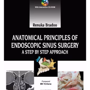 Anatomical Principles Of Endoscopic Sinus Surgery: A Step By Step Approach With Interactive Cd-Rom