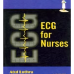 Ecg For Nurses