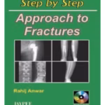 Step By Step Approach To Fractures With Cd-Rom