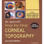 Dr.Agarwals' Step By Step Corneal Topography With Dvd-Rom