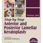 Step By Step Anterior And Posterior Lamellar Keratoplasty(With Dvd)