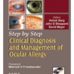 Step By Step Clinical Diagnosis And Management To Ocular Allergy With Photo Cd-Rom