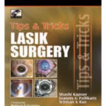 Tips & Tricks Lasik Surgery With Dvd Rom