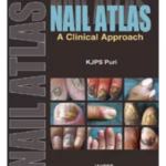 Nail Atlas A Clinical Approach