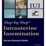 Step By Step Intrauterine Insemination Iui With Dvd-Rom