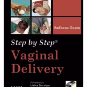 Step By Step Vaginal Delivery With Dvd-Rom