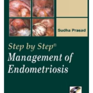 Step By Step Management Of Endometriosis With Dvd-Rom