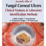 Aravind'S Atlas Of Fungal Corneal Ulcers Clinical Features & Lab.Identification Methods