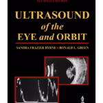 Ultrasound Of The Eye And Orbit