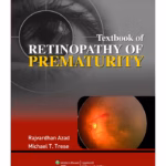 T.B of Retinopathy of Prematurity