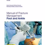 AO Trauma Manual of Fracture Management - Foot and Ankle 1st Ed(Indian Reprint)
