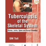 Tuberculosis Of The Skeletal System (Bones, Joints, Spine And Bursal Sheaths)