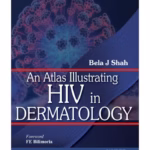 An Atlas Illustrating Hiv In Dermatology