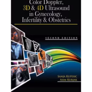 Color Doppler,3D &4D Ultrasound In Gynecology Infertility & Obstetrics
