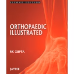 Orthopedics Illustrated