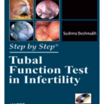Step By Step Tubal Function Test In Infertility With Dvd-Rom